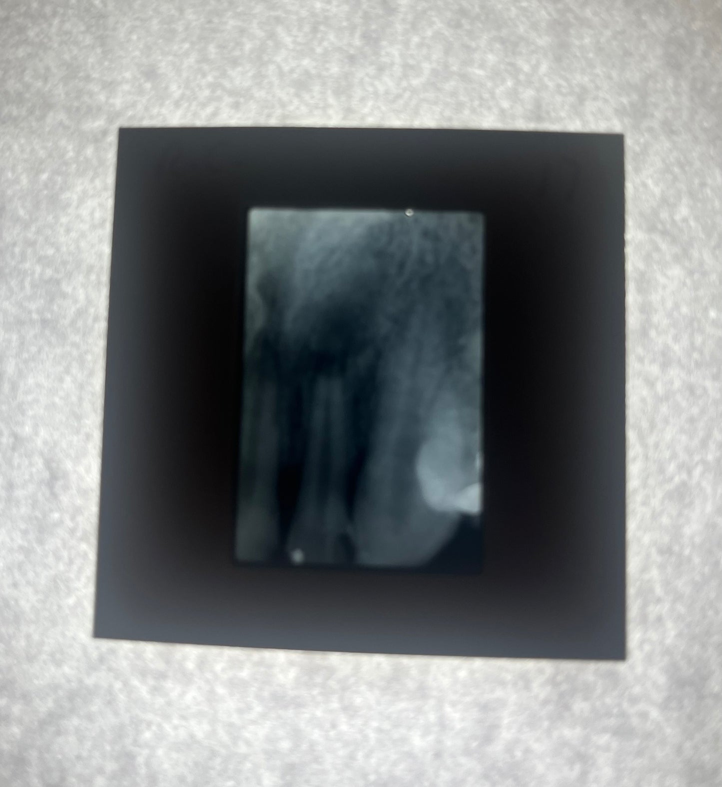 Dental X-Ray (Bitewing) Slide