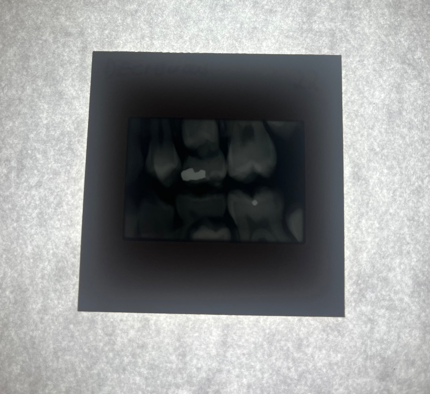 Dental X-Ray (Bitewing) Slide