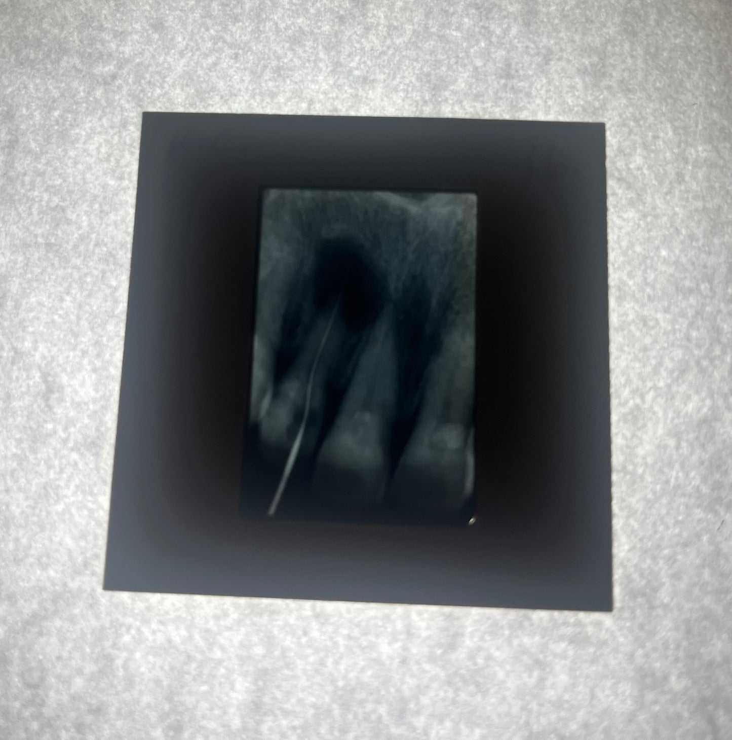 Dental X-Ray (Bitewing) Slide