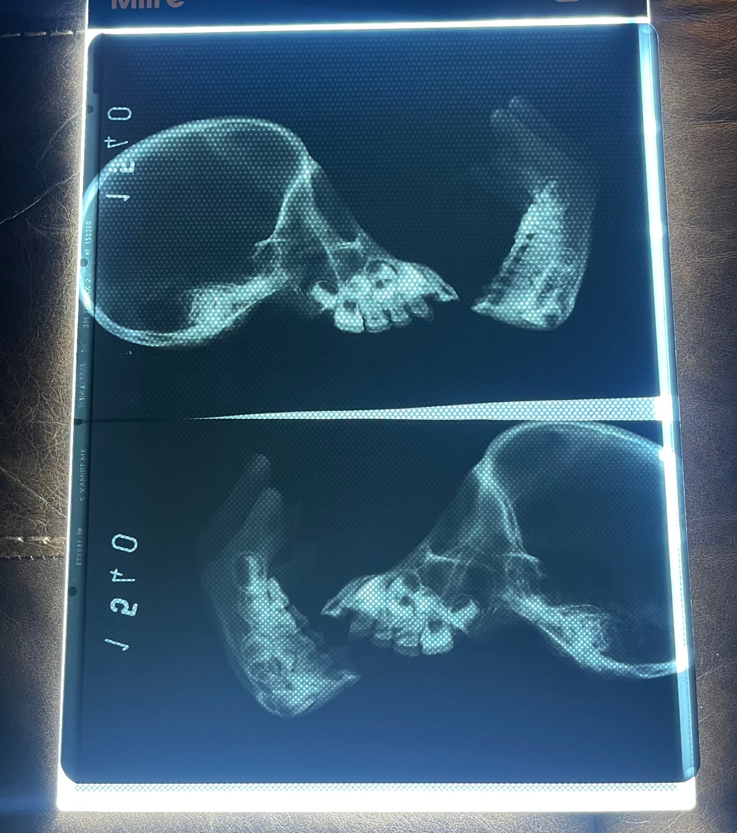 Primate Skull X-Ray