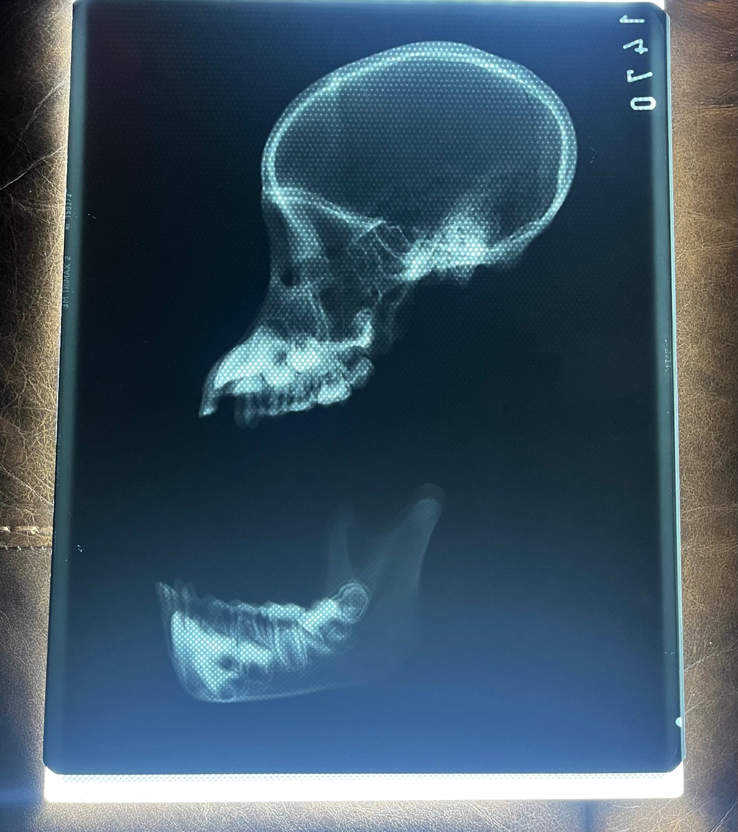 Primate Skull X-Ray