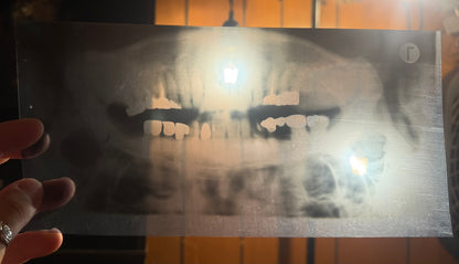 Dental X-Ray (Panoramic)